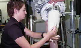 Woman creating cast of residual limb [3 of 4 photographs]