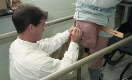 Man's residual limb being measured and examined [4 of 4 photographs]